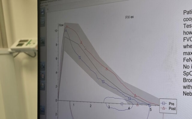 Computer screen graphs showing peak respiratory flow under a series of different experiments.